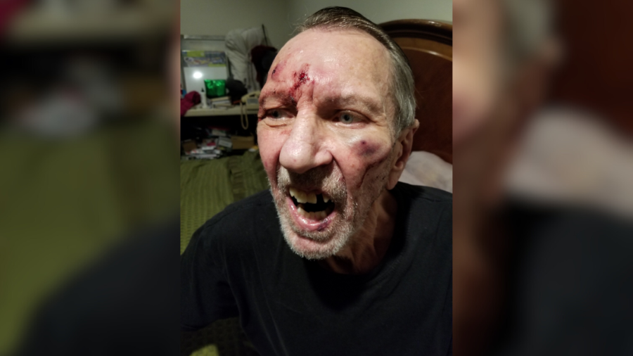 70-year-old Uber driver brutally beaten by passenger in Los Angeles [Video]