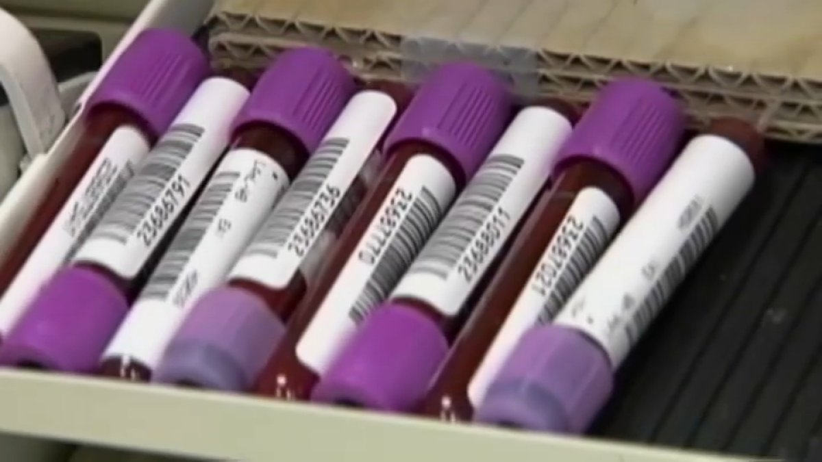 FDA approves Bay Area companys colon cancer screening test  NBC Bay Area [Video]