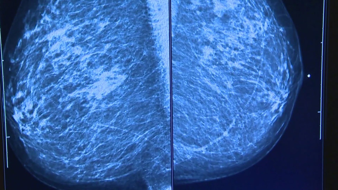 New FDA requirement about breast density that advocates say could save lives [Video]