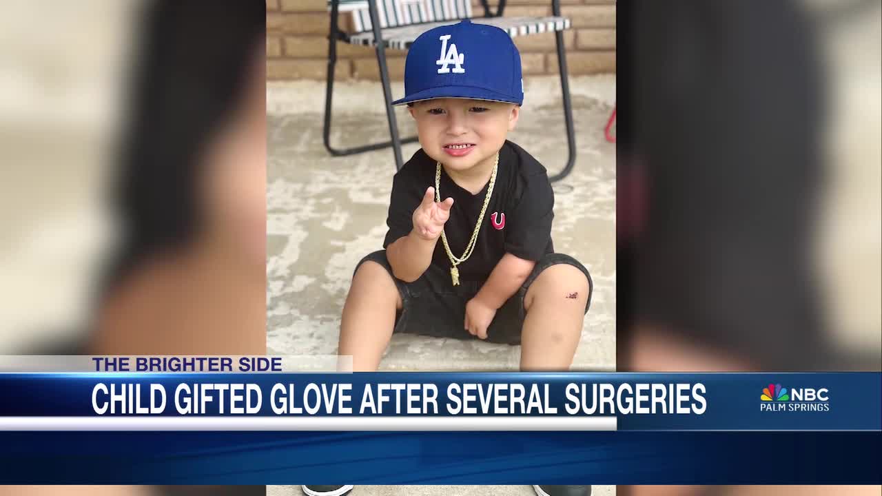 Boy gifted custom baseball glove after rare condition impacts his hands [Video]