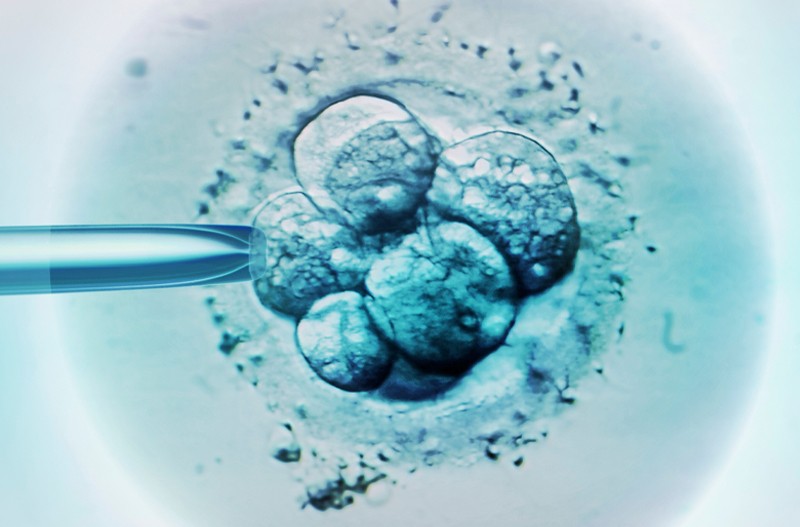 US Startup Charging Wealthy Parents To ‘Screen Embryos For IQ [Video]