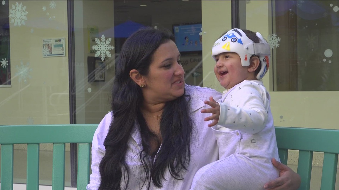 San Diego nonprofit performs surgeries free of charge for kids in need [Video]